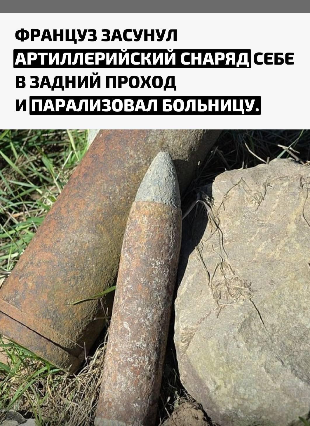 24-летний житель Тулузы обратился к врачам с жалобой на острую боль. Рентген показал шокирующую картину: в прямой кишке застрял 20-сантиметровый артиллерийский снаряд времён Первой мировой войны.