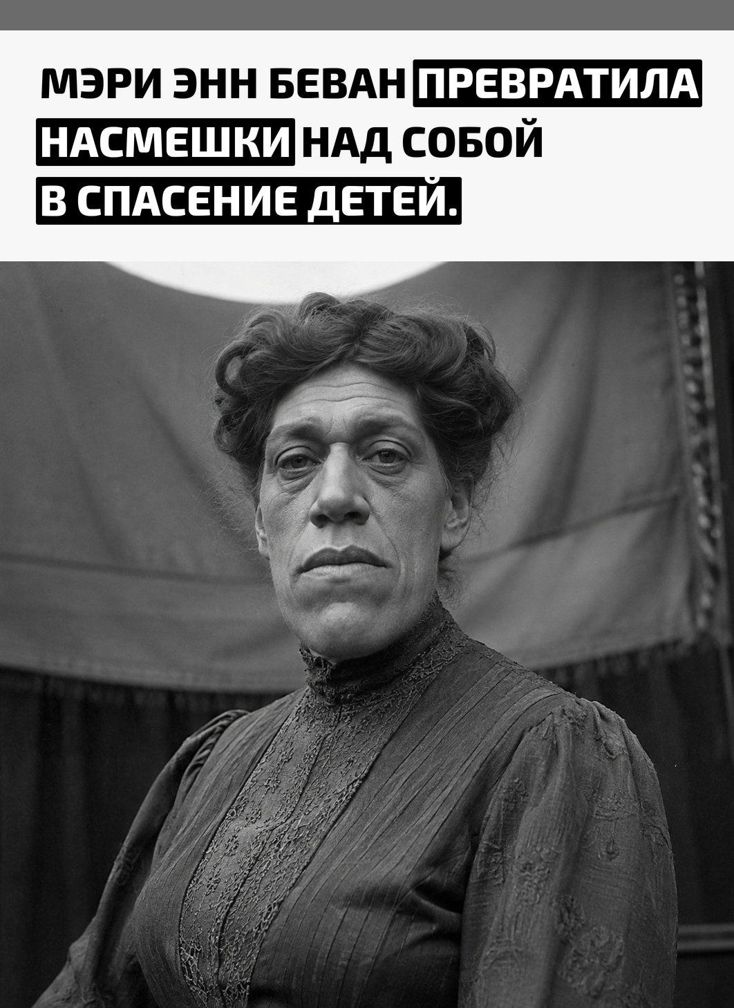 В начале XX века лондонская медсестра Мэри Энн Беван была матерью четверых детей, пока акромегалия не изменила её внешность и здоровье