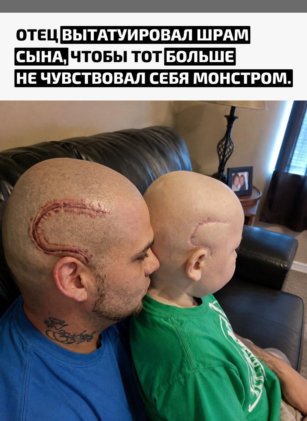 В шесть лет Габриэль Маршалл перенёс операцию из-за редкой опухоли мозга, после которой на голове остался заметный шрам. Мальчик тяжело переживал изменения во внешности и однажды признался отцу, что теперь кажется себе монстром.