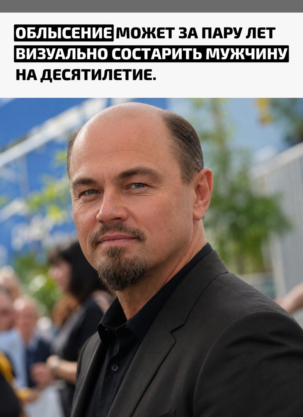 Одна и та же внешность с густыми волосами, залысинами и открытой макушкой воспринимается совершенно по-разному. Иногда кажется, будто между фотографиями прошли не месяцы, а годы с недосыпом, кредитами и очень насыщенной личной жизнью.