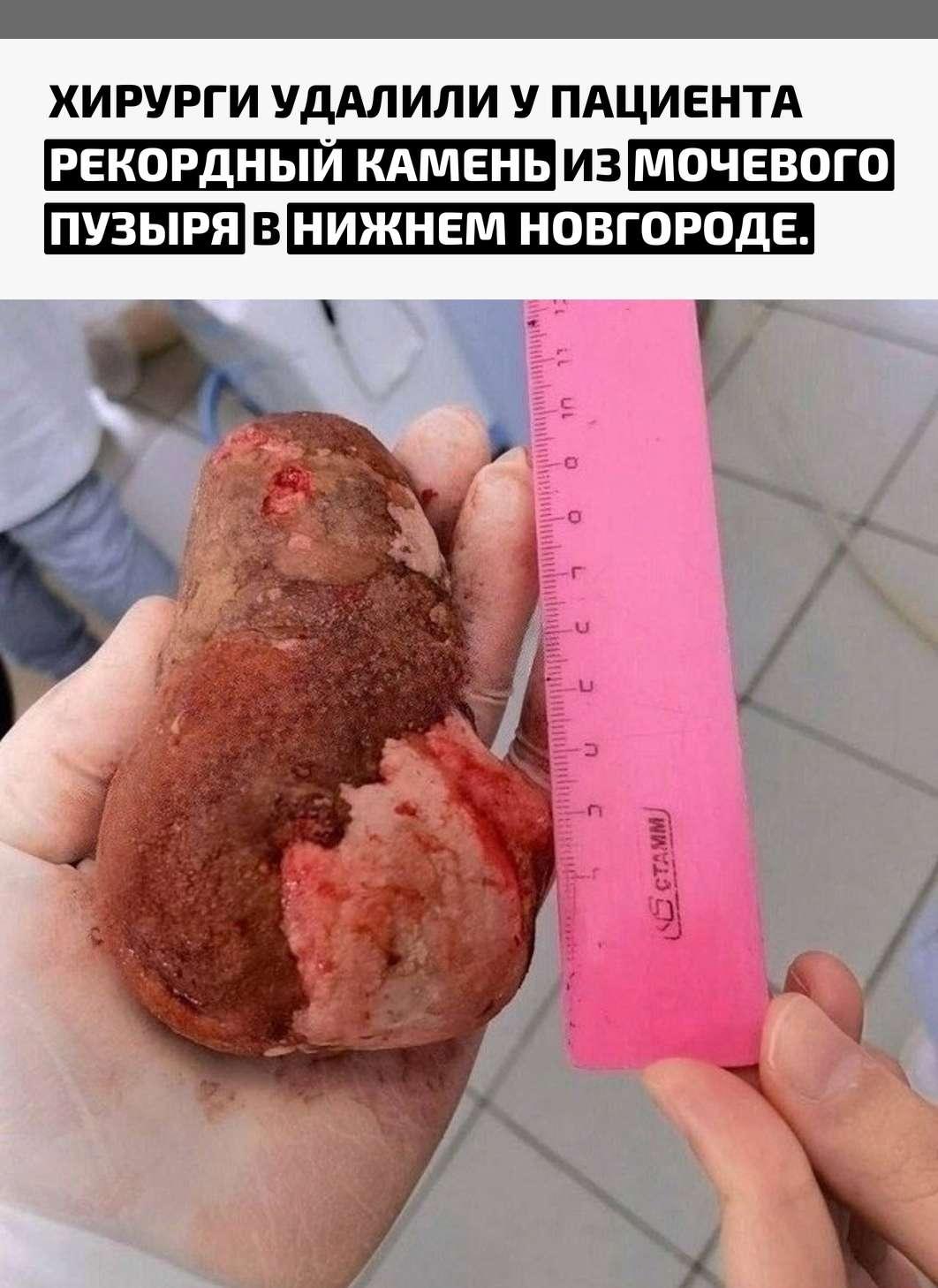 Рекорды и факты каждый день!