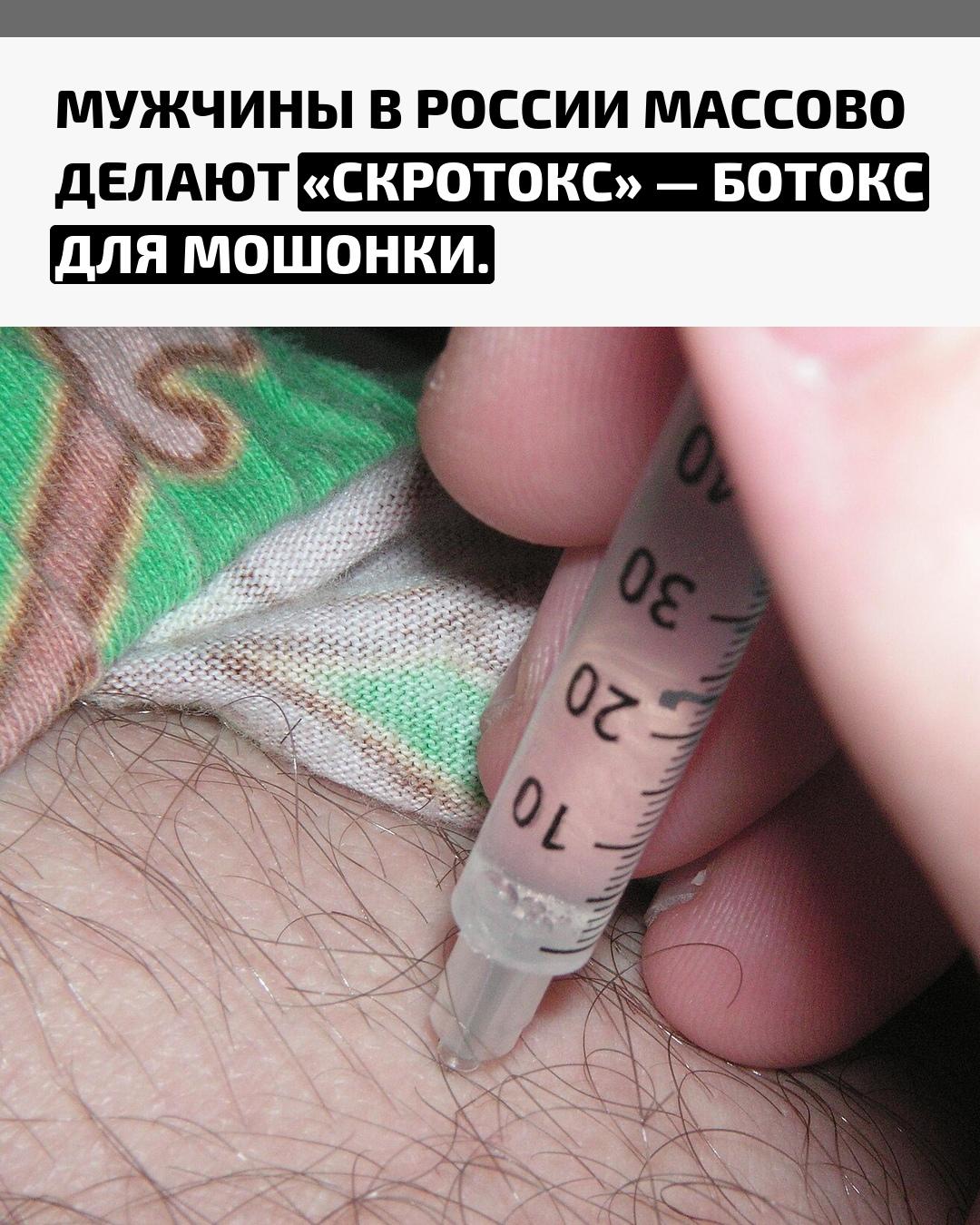 В стране резко вырос спрос на инъекции ботокса в интимной зоне. Мужчины решаются на процедуру, чтобы разгладить морщины и избавиться от потливости — эффект заметен уже после первого сеанса и держится до полугода.