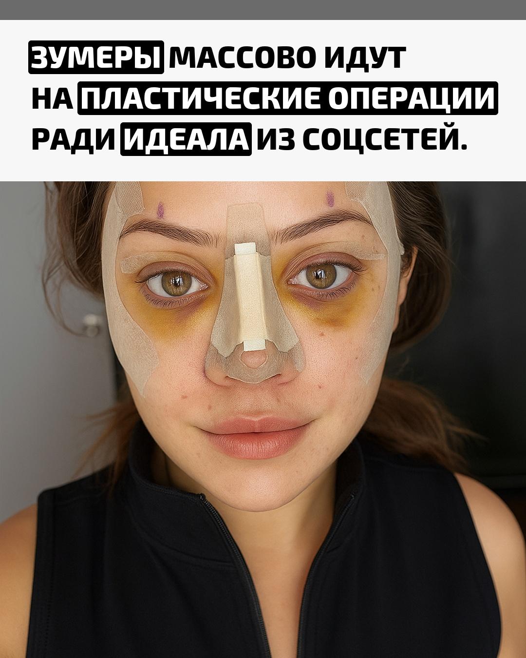 Все больше девушек до 30 лет решаются на подтяжки лица, блефаропластику и липофилинг. Психологи говорят, что мода на «совершенные» лица из соцсетей влияет на самооценку и формирует иллюзию, будто хирургия — обычная часть ухода за собой.